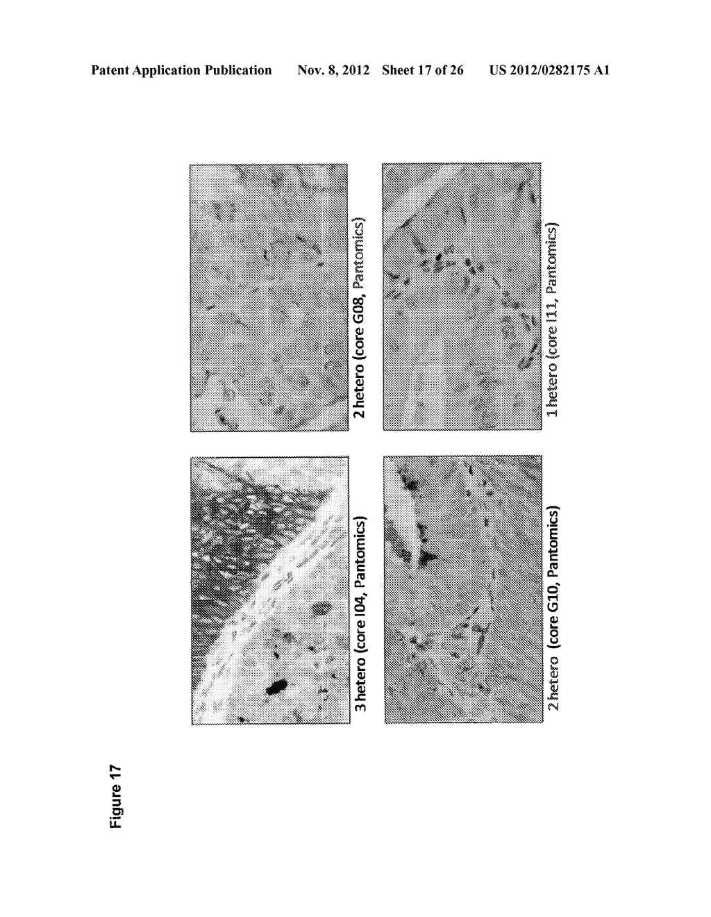 Methods for Increasing Efficacy of FOLR1 Cancer Therapy - diagram, schematic, and image 18