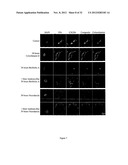 PROGNOSTIC,. SCREENING AND TREATMENT METHODS AND AGENTS FOR TREATMENT OF     METASTASIS AND INFLAMMATION USING 5T4 ONCOFOETAL GLYCOPROTEIN diagram and image