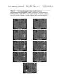 Improved Medicinal Aerosol Formulations diagram and image