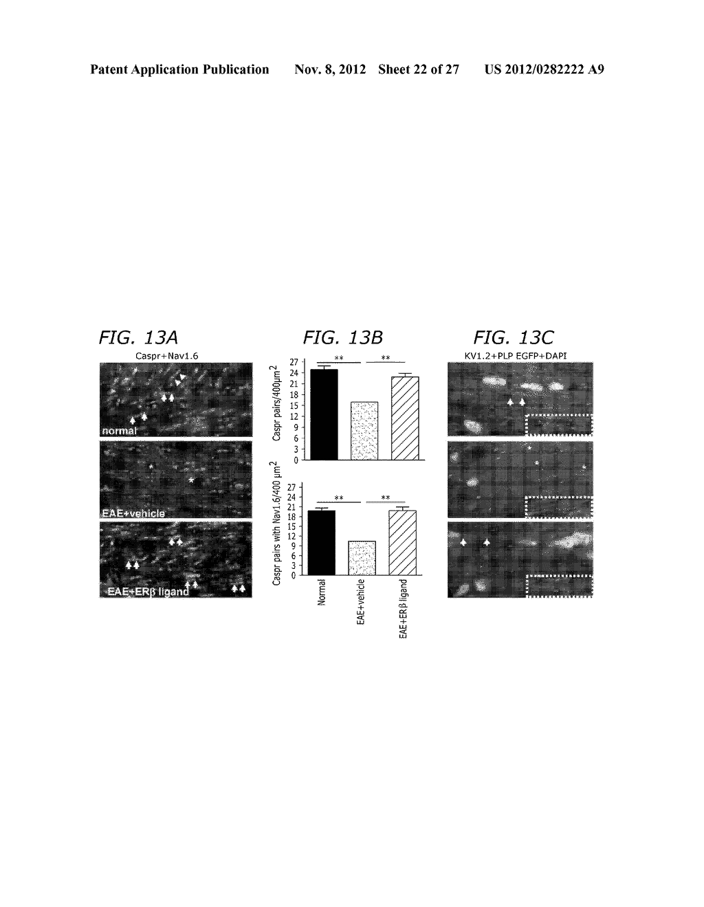 Estrogen receptor ligand and/or interferon beta treatment for     neurodegenerative diseases - diagram, schematic, and image 23