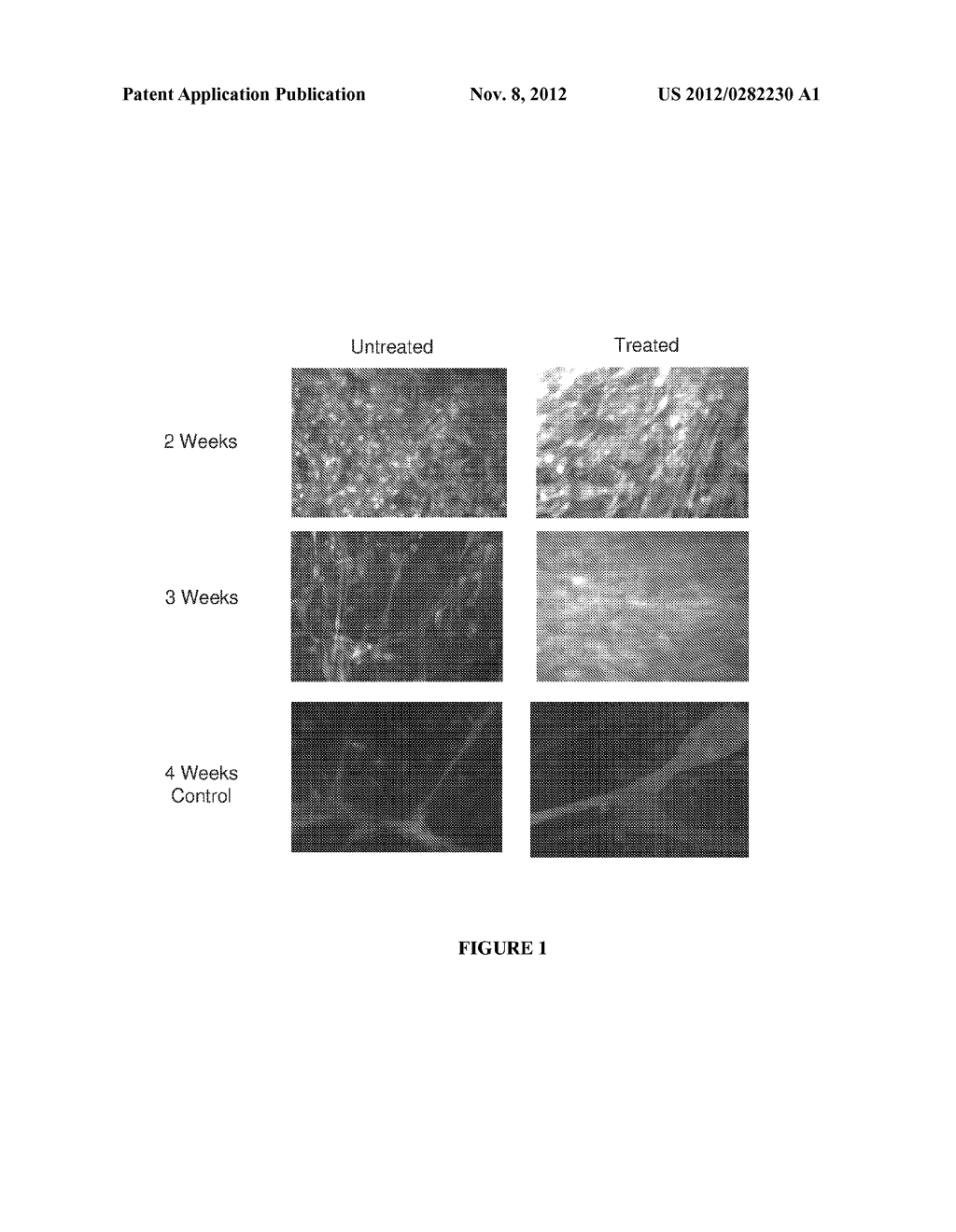 METHODS AND COMPOSITIONS FOR DIAGNOSIS AND TREATMENT OF GENETIC AND     RETINAL DISEASE - diagram, schematic, and image 02