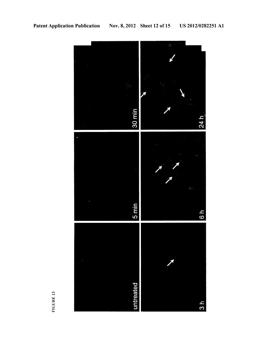 ANTI-CLUSTERIN ANTIBODIES AND ANTIGEN BINDING FRAGMENTS AND THEIR USE TO     REDUCE TUMOR VOLUME - diagram, schematic, and image 13