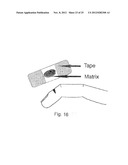 PROTEIN BIOMATERIALS AND BIOCOACERVATES AND METHODS OF MAKING AND USING     THEREOF diagram and image