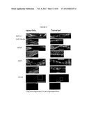 Methods for Promoting the Revascularization and Reenervation of CNS     Lesions diagram and image