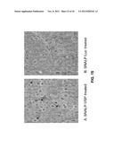 Lipid Formulated Compositions And Methods For Inhibiting Expression Of Eg5     And VEGF Genes diagram and image