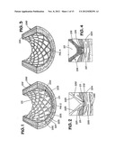 ENDOLUMINAL IMPLANTABLE SURFACES, STENTS, AND GRAFTS AND METHOD OF MAKING     SAME diagram and image