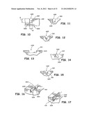 ENDOLUMINAL IMPLANTABLE SURFACES, STENTS, AND GRAFTS AND METHOD OF MAKING     SAME diagram and image