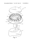 OFFSET IGNITER ASSEMBLY diagram and image