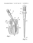ENDODONTIC INSTRUMENTS AND METHODS OF MANUFACTURING THEREOF diagram and image