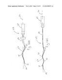 ENDODONTIC INSTRUMENTS AND METHODS OF MANUFACTURING THEREOF diagram and image