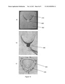 SURGICAL TRAINING AIDS AND METHODS OF FABRICATION THEREOF diagram and image