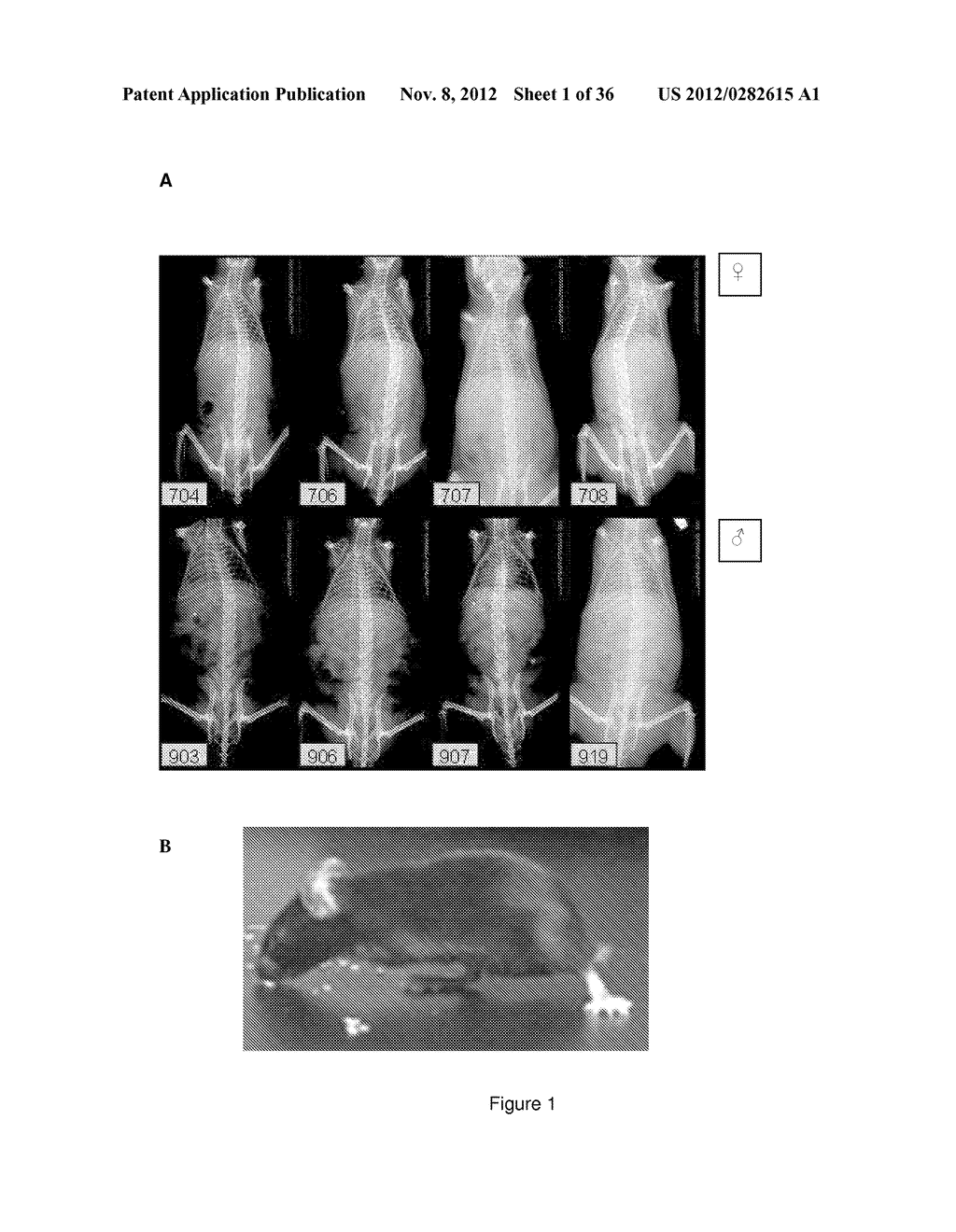 METHODS OF SCREENING FOR COMPOUNDS FOR USE AS MODULATORS OF LEFT-RIGHT     ASYMMETRY IN SCOLIOTIC SUBJECTS AND FOR MONITORING EFFICACY OF AN     ORTHOPAEDIC DEVICE - diagram, schematic, and image 02