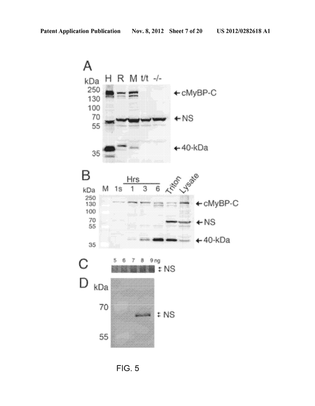 METHODS AND ASSAYS FOR RISK PREDICTION, DIAGNOSIS, AND ANALYSIS OF     MYOCARDIAL INFARCTION, HEART FAILURE AND REDUCED CARDIAC FUNCTION - diagram, schematic, and image 08