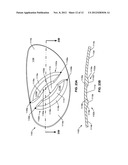 Golf Club Head or Other Ball Striking Device Having Stiffened Face Portion diagram and image