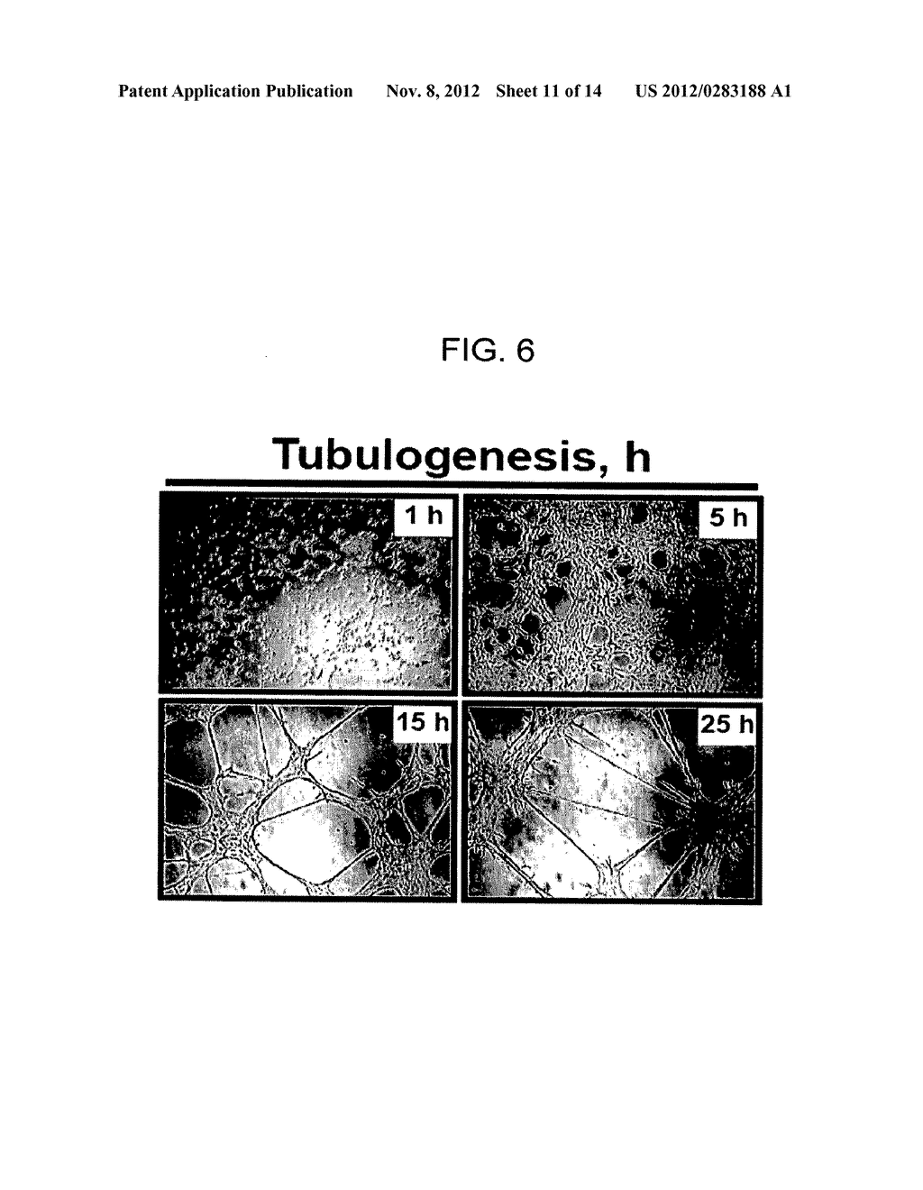 GENES AND PROTEINS ASSOCIATED WITH ANGIOGENESIS AND USES THEREOF - diagram, schematic, and image 12