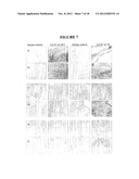 METHOD OF TREATING CONDITIONS ASSOCIATED WITH AIRWAY TISSUE REMODELING diagram and image