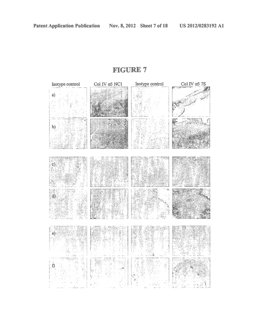 METHOD OF TREATING CONDITIONS ASSOCIATED WITH AIRWAY TISSUE REMODELING - diagram, schematic, and image 08