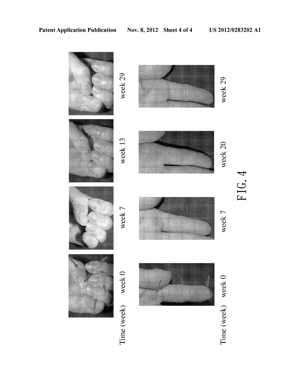 ANTI-WART PHARMACEUTICAL COMPOSITION AND METHOD FOR TREATING WART - diagram, schematic, and image 05