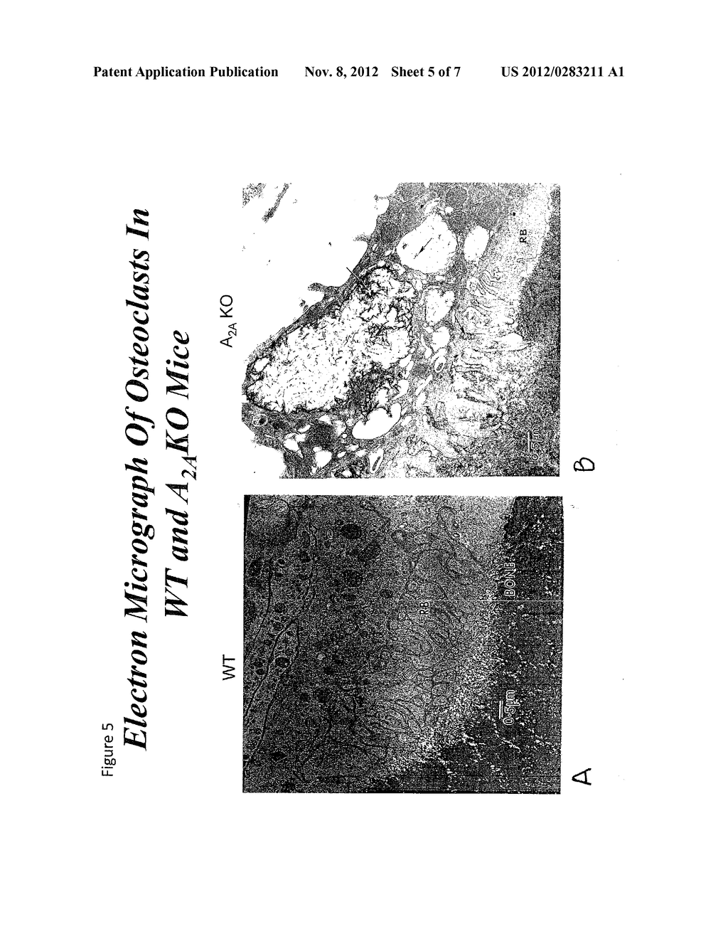 MEDICAL IMPLANTS CONTAINING ADENOSINE RECEPTOR AGONISTS AND METHODS FOR     INHIBITIING MEDICAL IMPLANT LOOSENING - diagram, schematic, and image 06