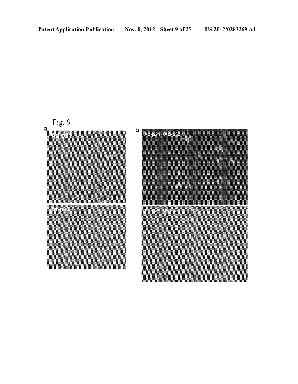 Method and Compositions for Suppression of Aging - diagram, schematic, and image 10