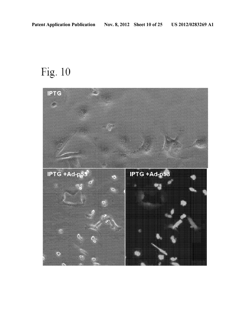 Method and Compositions for Suppression of Aging - diagram, schematic, and image 11