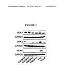 INHIBITION AND TREATMENT OF PROSTATE CANCER METASTASIS diagram and image