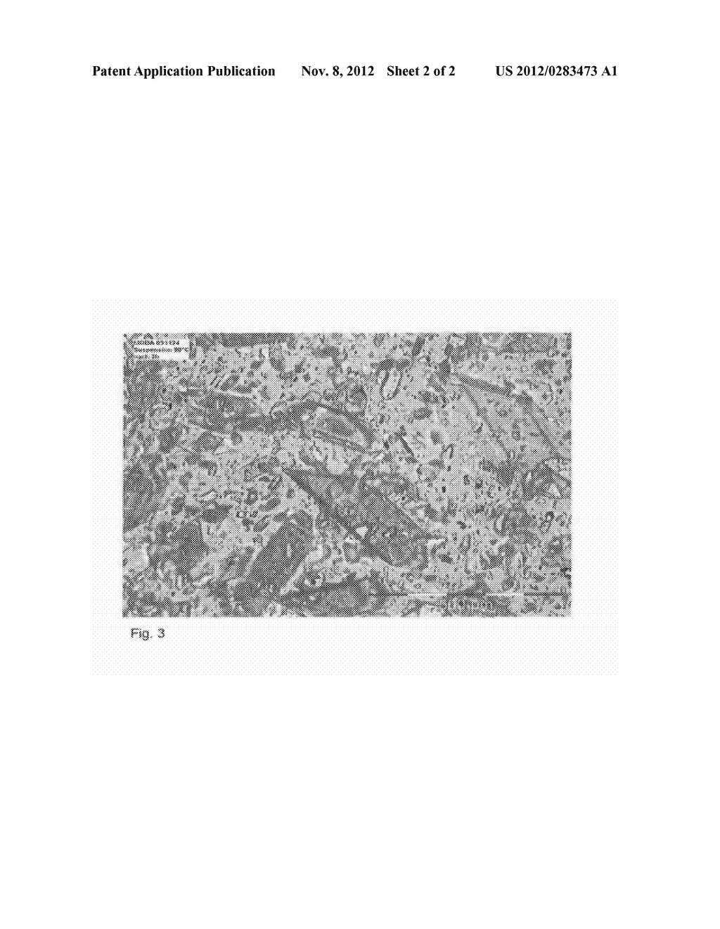 PROCESS FOR THE PREPARATION OF A CRYSTALLINE L-MGDA TRIALKALI METAL SALT - diagram, schematic, and image 03