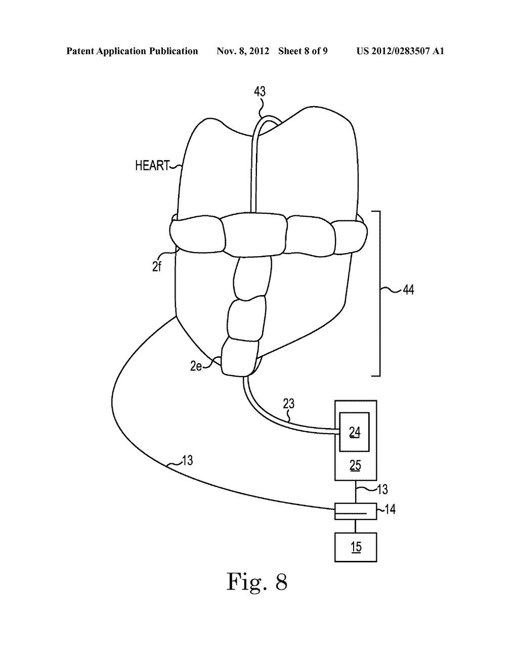 Cardiac Assist Devices - diagram, schematic, and image 09