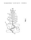 INSTRUMENT WITH SEALING DEVICE AND METHODS OF ADVANCING FLUID THERETHROUGH diagram and image