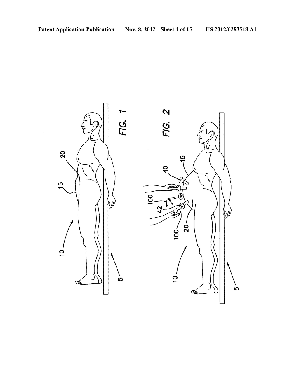 LOW-PROFILE SURGICAL UNIVERSAL ACCESS PORT - diagram, schematic, and image 02