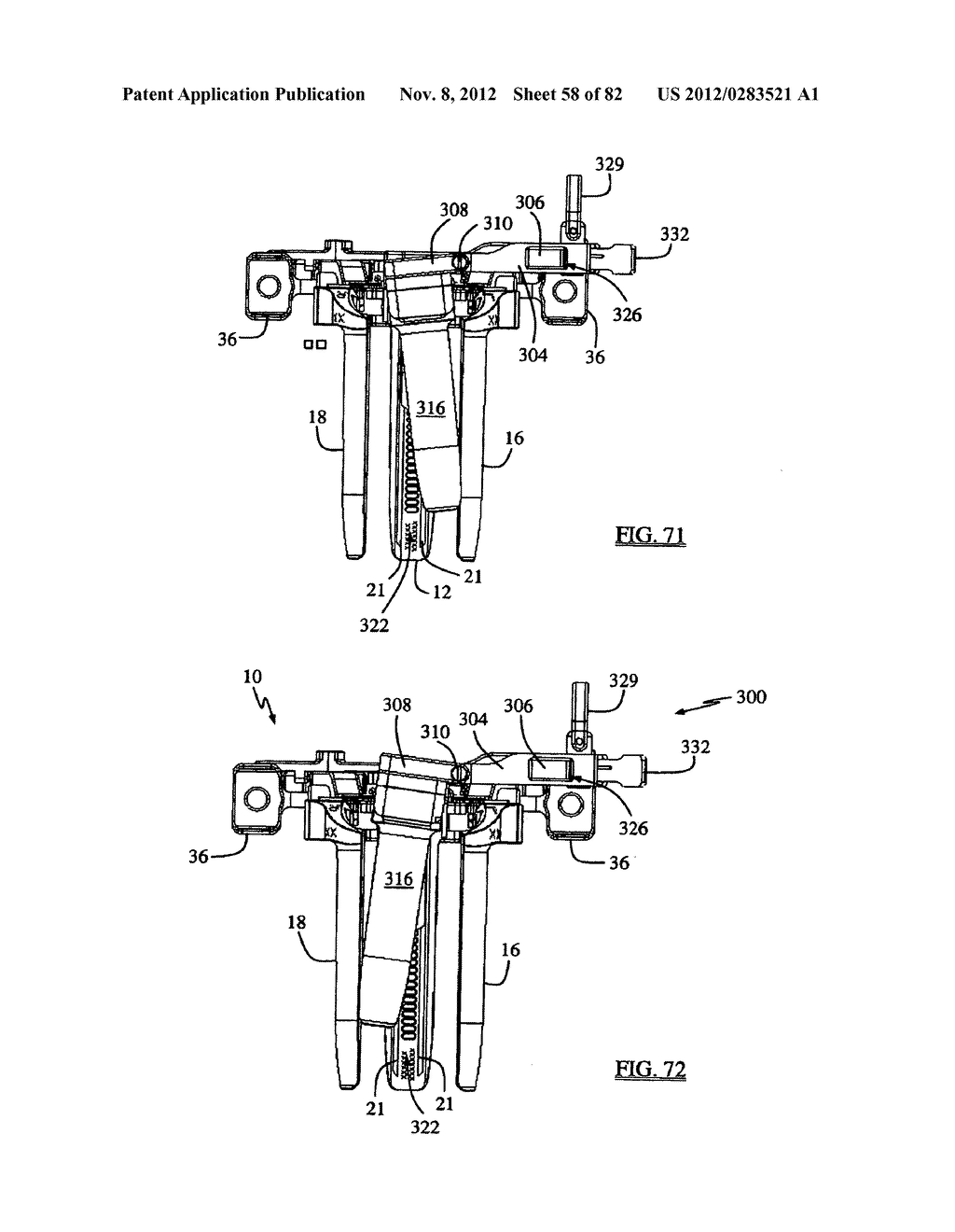 SURGICAL ACCESS SYSTEM AND RELATED METHODS - diagram, schematic, and image 59