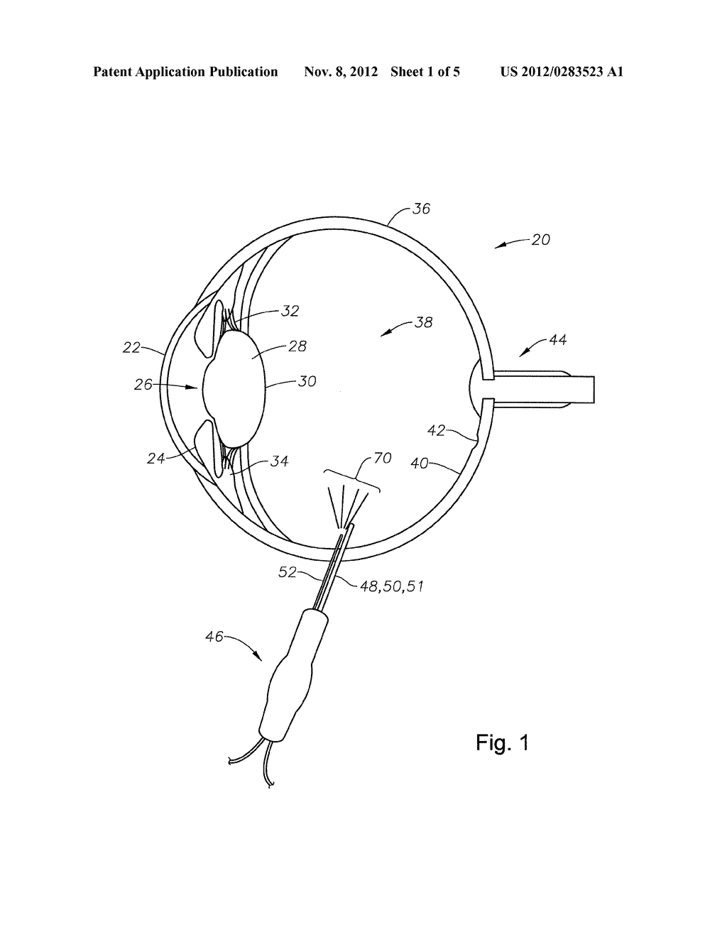 ILLUMINATED MICROSURGICAL INSTRUMENT INCLUDING OPTICAL FIBER WITH BEVELED     END FACE - diagram, schematic, and image 02