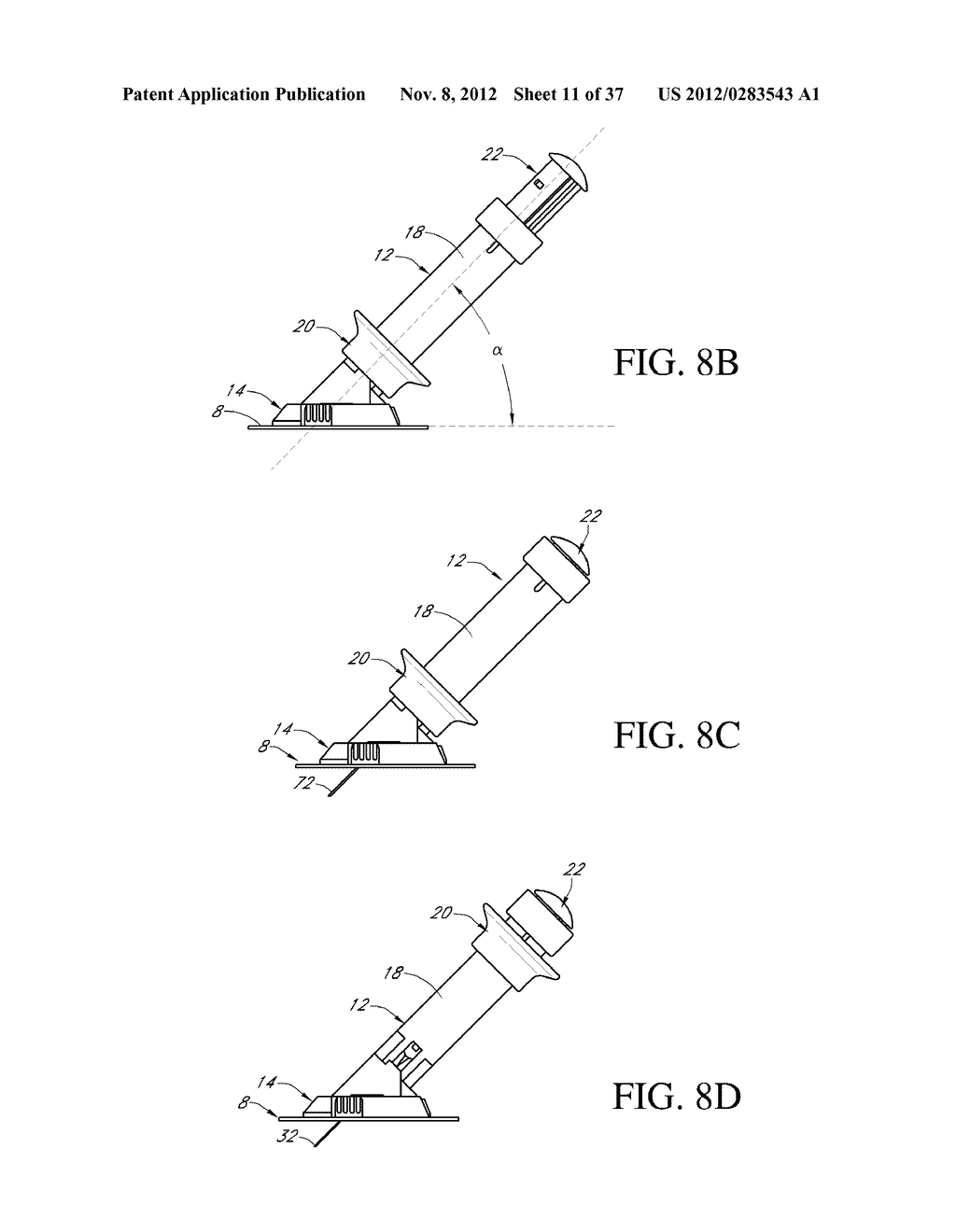 TRANSCUTANEOUS ANALYTE SENSOR - diagram, schematic, and image 12