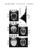 MAGNETIC RESONANCE IMAGING USING VELOCITY SELECTIVE EXCITATION diagram and image