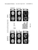 MAGNETIC RESONANCE IMAGING USING VELOCITY SELECTIVE EXCITATION diagram and image