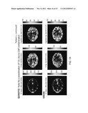 MAGNETIC RESONANCE IMAGING USING VELOCITY SELECTIVE EXCITATION diagram and image