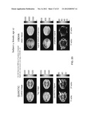 MAGNETIC RESONANCE IMAGING USING VELOCITY SELECTIVE EXCITATION diagram and image