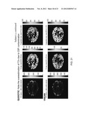 MAGNETIC RESONANCE IMAGING USING VELOCITY SELECTIVE EXCITATION diagram and image