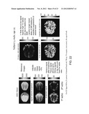 MAGNETIC RESONANCE IMAGING USING VELOCITY SELECTIVE EXCITATION diagram and image