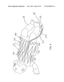 COIL SYSTEM AND METHOD FOR OBTAINING VOLUMETRIC PHYSIOLOGICAL MEASUREMENTS diagram and image