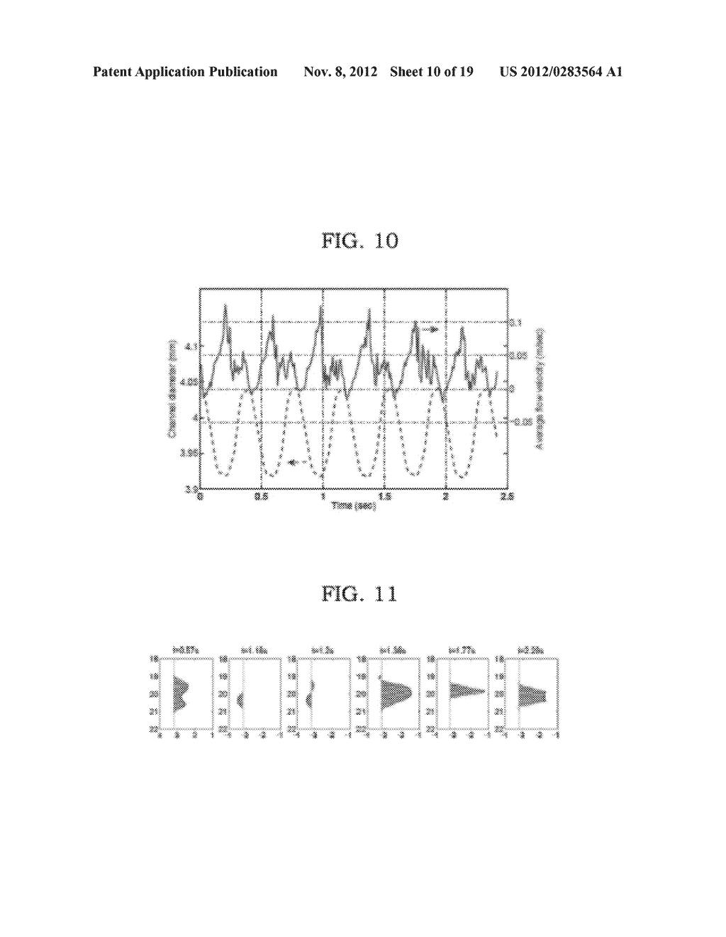 VASCULAR CHARACTERIZATION USING ULTRASOUND IMAGING - diagram, schematic, and image 11