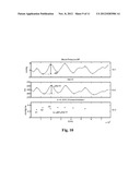 METHOD AND APPARATUS FOR ARTERIAL BLOOD PRESSURE MEASUREMENT AND     INDIVIDUALIZED RECTIFYING TECHNOLOGY diagram and image