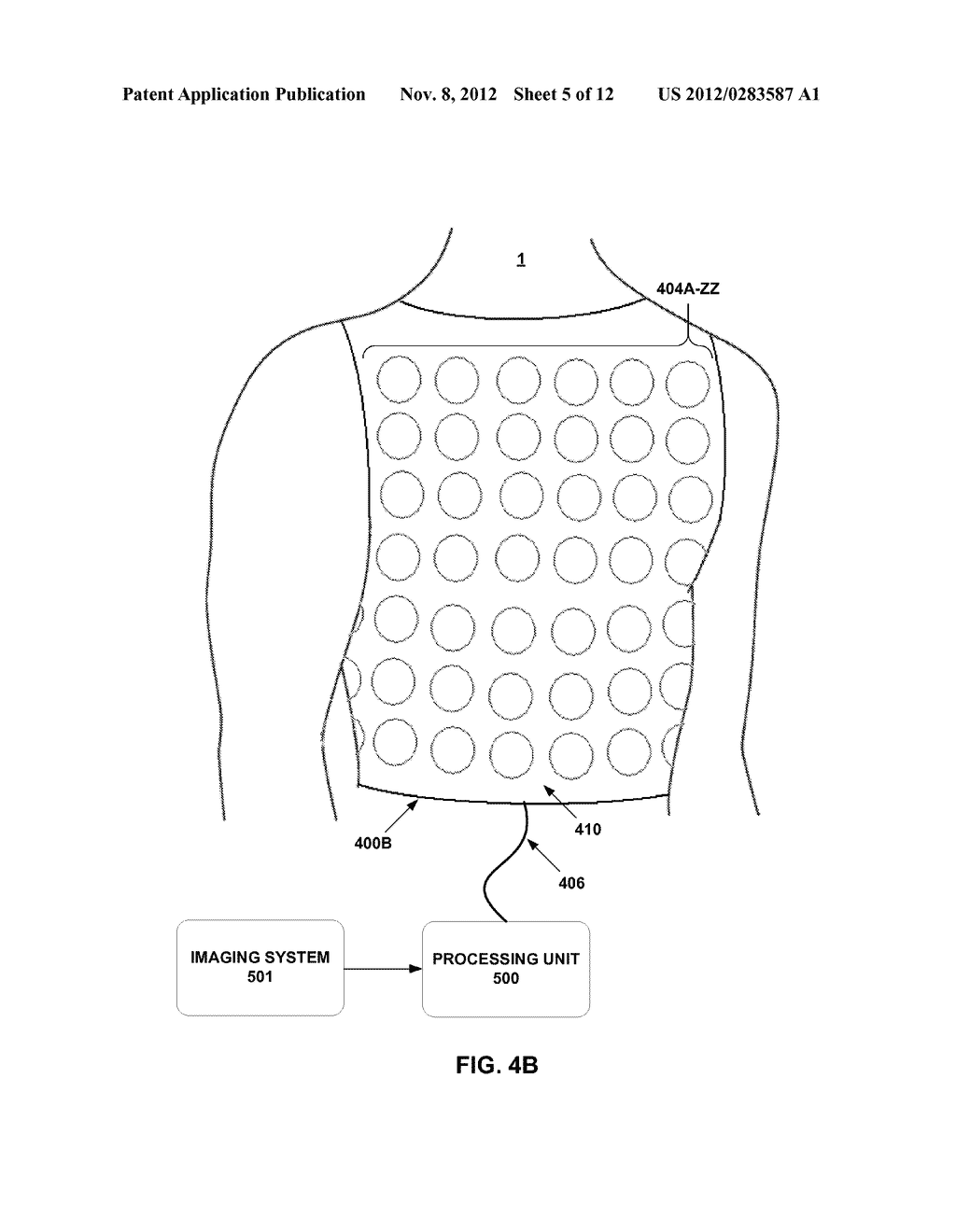 ASSESSING INTRA-CARDIAC ACTIVATION PATTERNS AND ELECTRICAL DYSSYNCHRONY - diagram, schematic, and image 06