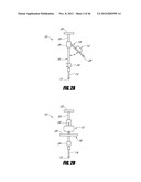 HIP SURGERY SYSTEMS AND METHODS diagram and image