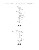 HIP SURGERY SYSTEMS AND METHODS diagram and image