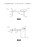 HIP SURGERY SYSTEMS AND METHODS diagram and image