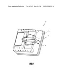 HIP SURGERY SYSTEMS AND METHODS diagram and image