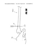 HIP SURGERY SYSTEMS AND METHODS diagram and image