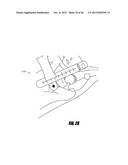 HIP SURGERY SYSTEMS AND METHODS diagram and image