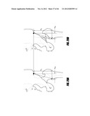 HIP SURGERY SYSTEMS AND METHODS diagram and image